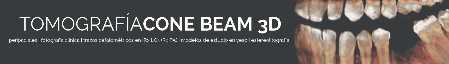 tomografia-cone-beam-3d-1
